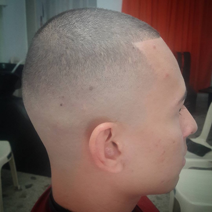 bald comb over fade1