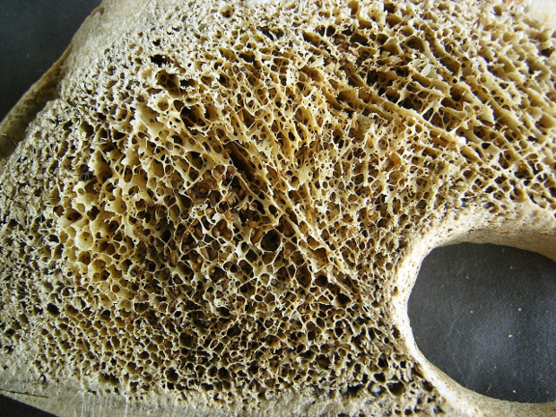 high quality bone texture